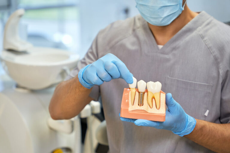 Fragment photo of a medical worker in mask and gloves demonstrating how dental implants work